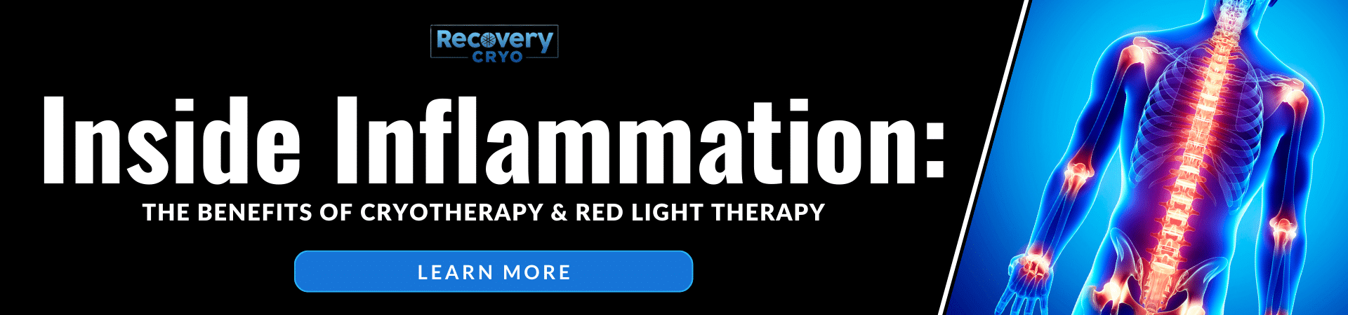 Inside Inflammation: The Benefits of Cryotherapy and Red Light Therapy